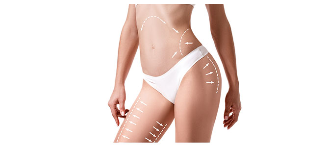 Cellulite Paddles Specialist Near Me in Oklahoma City, OK Cellulite Paddles Specialist Near Me in Oklahoma City, OK