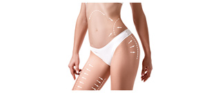 Cellulite Paddles Specialist Near Me in Oklahoma City, OK Cellulite Paddles Specialist Near Me in Oklahoma City, OK