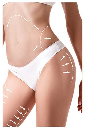 Cellulite Paddles Specialist Near Me in Oklahoma City, OK