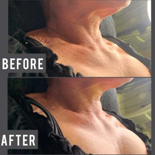 Body Sculpting Before and After in Oklahoma City OKC 