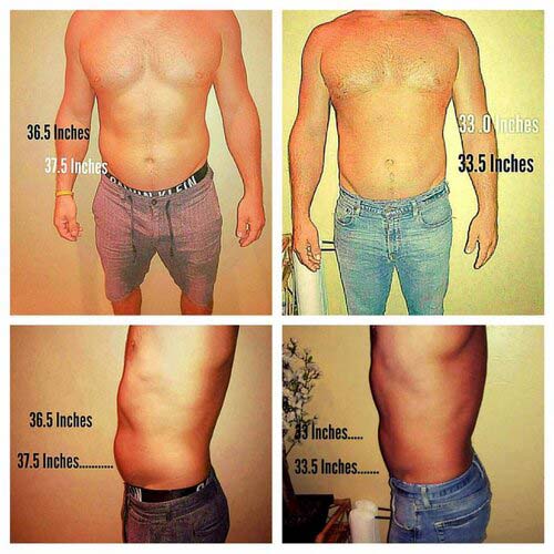 Vevazz Laser Light Lipo Therapy Before and After 