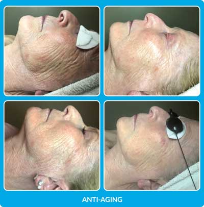 Anti Aging Before and After Photos at Petra’s Massage Therapy & Weight Loss Clinic in Oklahoma City