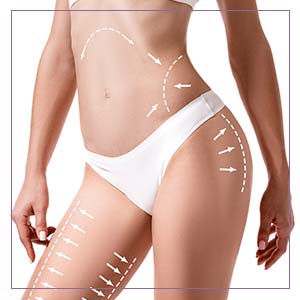 Cellulite Paddles Specialist Near Me in Oklahoma City, OKC