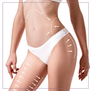 Cellulite Paddles Specialist Near Me in Oklahoma City, OKC