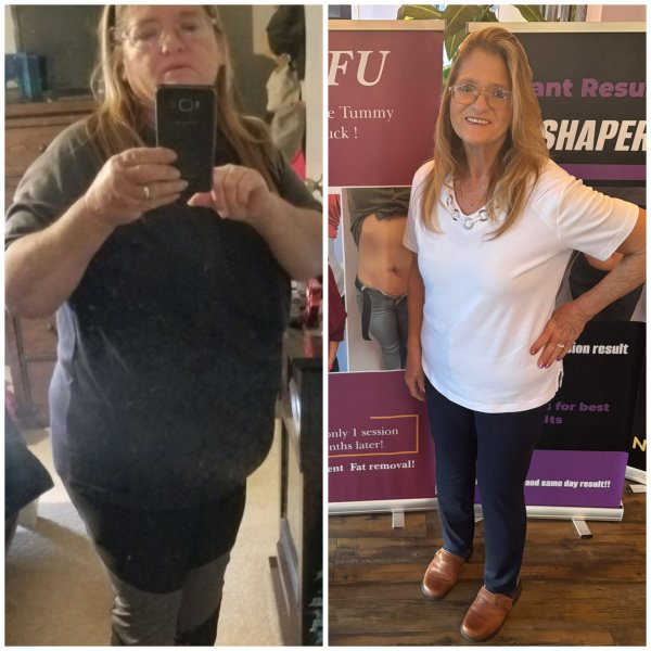 Before and After Photos of Petra’s Massage Therapy & Weight Loss Clinic