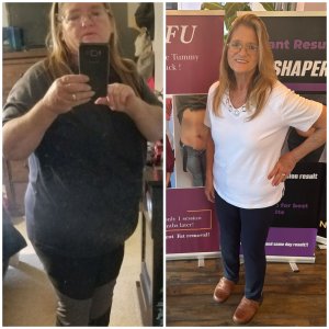 Before and After Photos of Petra’s Massage Therapy & Weight Loss Clinic