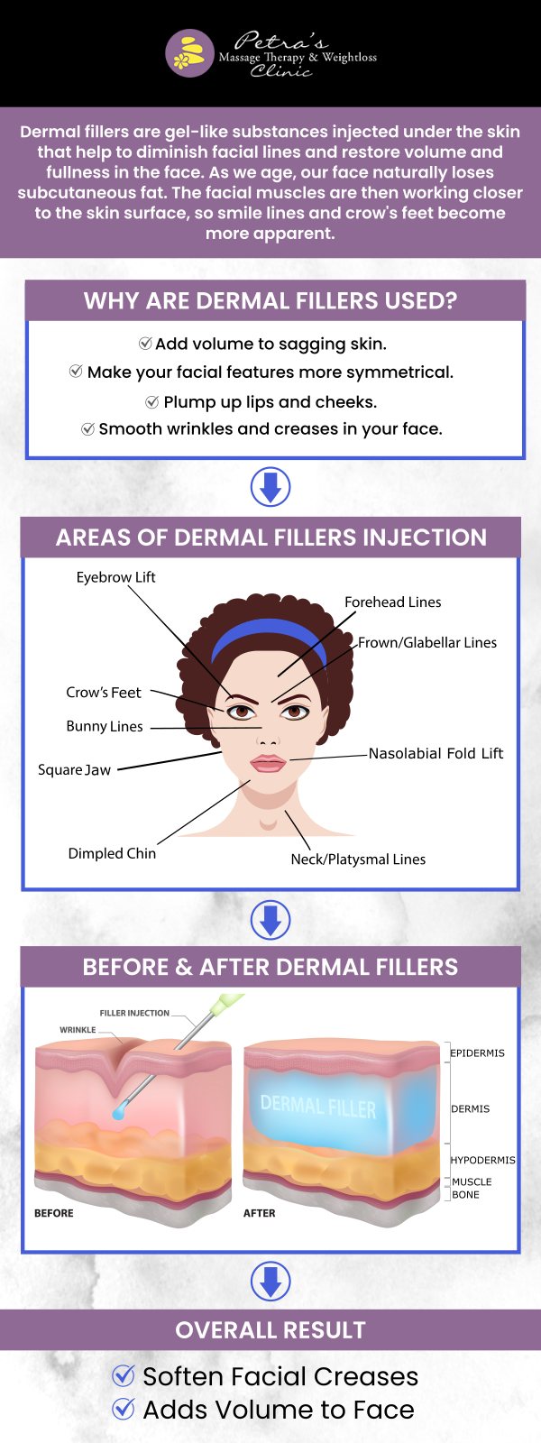 Add volume to plump lips, and smooth lines, or lift & contour cheeks by getting facial fillers from our experienced medical professionals at Petra’s Massage Therapy & Weight Loss Clinic. For more information, contact us today or schedule an appointment online. We are conveniently located at 7200 N May Ave Suite A Oklahoma City, OK 73116.