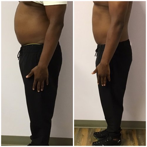 Body Sculpting Before and After in Oklahoma City OKC Body Sculpting Before and After in Oklahoma City OKC