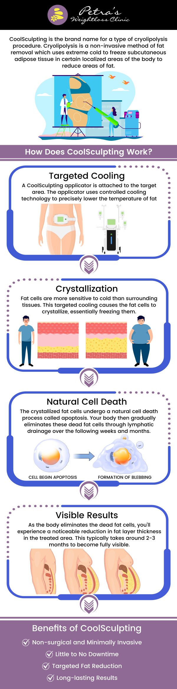 A non-invasive treatment to remove subcutaneous body fat involves the freezing of areas that leads to a reduction in the fat layer. Visit Petra’s Weight Loss Clinic, for more information. Contact us today or schedule an appointment online. We are conveniently located at 7200 N May Ave. Suite A, Oklahoma City, OK 73116. A non-invasive treatment to remove subcutaneous body fat involves the freezing of areas that leads to a reduction in the fat layer. Visit Petra’s Weight Loss Clinic, for more information. Contact us today or schedule an appointment online. We are conveniently located at 7200 N May Ave. Suite A, Oklahoma City, OK 73116.