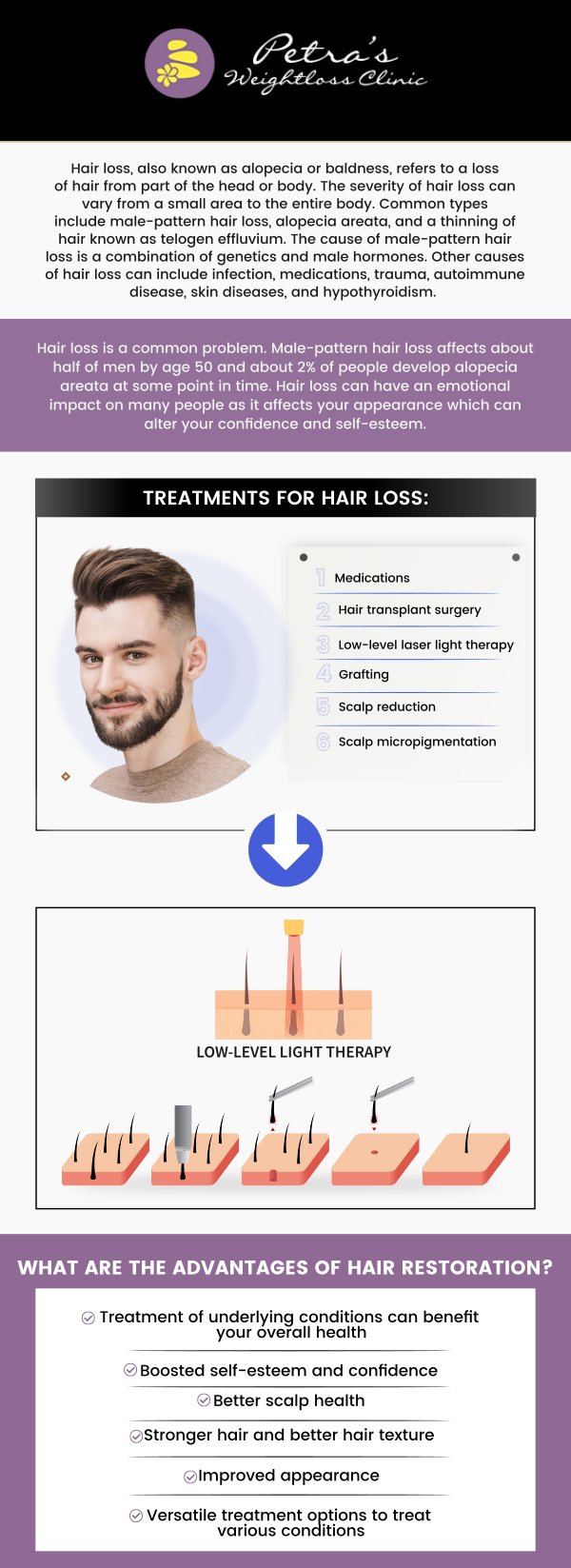 Common questions asked by patients: Who is a good candidate for hair restoration? How does hair restoration work? How long does a hair restoration procedure take? How many sessions of hair restoration Will I need? Hair restoration is a medical procedure designed to treat hair loss and promote regrowth, using various techniques. Dr. Petra Whisenhunt, T.N.D, at Petra’s Weight Loss Clinic offers personalized hair restoration treatments to restore natural hair density and improve overall scalp health. For more information, contact us today at Petra’s Weight Loss Clinic or schedule an appointment online. Our clinic is conveniently located at 7200 N May Ave Suite A Oklahoma City, OK 73116. We serve patients from Oklahoma City OKC, Midwest City OKC, Del City OKC, Valley Brook OKC, Forest Park OKC, Nichols Hills OKC, Bethany OKC, and BEYOND! Common questions asked by patients: Who is a good candidate for hair restoration? How does hair restoration work? How long does a hair restoration procedure take? How many sessions of hair restoration Will I need?
Hair restoration is a medical procedure designed to treat hair loss and promote regrowth, using various techniques. Dr. Petra Whisenhunt, T.N.D, at Petra’s Weight Loss Clinic offers personalized hair restoration treatments to restore natural hair density and improve overall scalp health. For more information, contact us today at Petra’s Weight Loss Clinic or schedule an appointment online. Our clinic is conveniently located at 7200 N May Ave Suite A Oklahoma City, OK 73116. We serve patients from Oklahoma City OKC, Midwest City OKC, Del City OKC, Valley Brook OKC, Forest Park OKC, Nichols Hills OKC, Bethany OKC, and BEYOND!