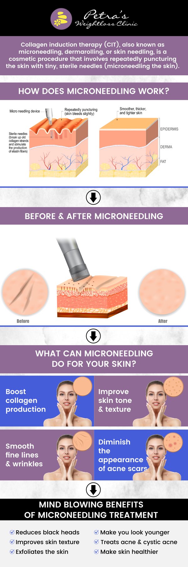 Microneedling is a powerful skin rejuvenation treatment that targets multiple skin concerns, such as signs of aging, pigmentation issues, enlarged pores, and scarring. This non-invasive procedure stimulates collagen production, helping to improve skin texture and tone. At Petra's Weight Loss Clinic, our experienced team provides personalized care to ensure you achieve the best results, addressing your specific skin needs in just a few sessions. For more information, contact us today at Suburban Healthcare Associates or book an appointment online. Our clinic is conveniently located at 7200 N May Ave Suite A Oklahoma City OK 73116. Microneedling is a powerful skin rejuvenation treatment that targets multiple skin concerns, such as signs of aging, pigmentation issues, enlarged pores, and scarring. This non-invasive procedure stimulates collagen production, helping to improve skin texture and tone. At Petra's Weight Loss Clinic, our experienced team provides personalized care to ensure you achieve the best results, addressing your specific skin needs in just a few sessions. For more information, contact us today at Suburban Healthcare Associates or book an appointment online. Our clinic is conveniently located at 7200 N May Ave Suite A Oklahoma City OK 73116.