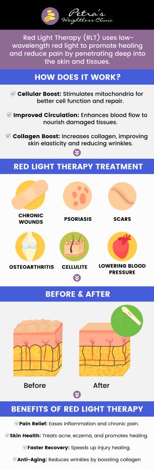 Red light therapy is effective for a variety of health and cosmetic issues. It is particularly beneficial for skin conditions, helping to improve the appearance of stretch marks, scars, sun-damaged skin, rosacea, psoriasis, eczema, and altering facial texture. Red laser light therapy is available at Petra’s Weight Loss Clinic. For more information, please contact us now or visit us online to book your next appointment today! We are conveniently located at 7200 N May Ave Suite A Oklahoma City, OK 73116.